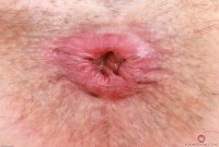 ATK hairy Ella Nova Set