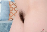 ATK hairy  in young and hairy