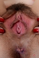 ATK hairy  in young and hairy