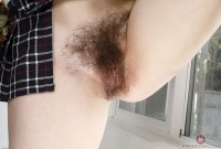 ATK hairy  in young and hairy