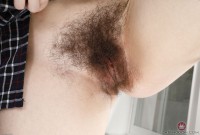 ATK hairy  in young and hairy