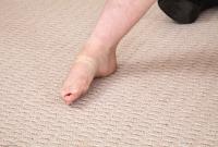 ATK hairy  in young and hairy