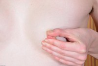 ATK hairy  in young and hairy