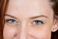 ATK hairy  in young and hairy