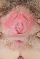 ATK hairy  in young and hairy