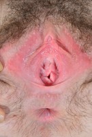 ATK hairy  in young and hairy