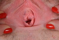 ATK hairy  in young and hairy