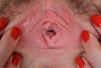 ATK hairy  in young and hairy