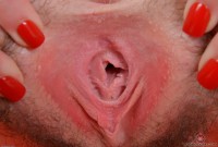 ATK hairy  in young and hairy