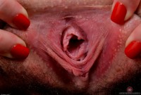 ATK hairy  in young and hairy