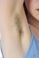ATK hairy  in young and hairy