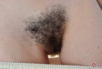 ATK hairy  in young and hairy