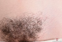 ATK hairy  in young and hairy