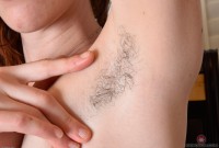 ATK hairy  in young and hairy