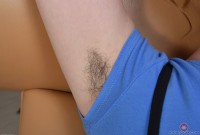ATK hairy  in young and hairy