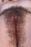 ATK hairy  in young and hairy