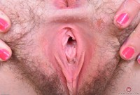 ATK hairy  in young and hairy