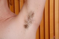 ATK hairy  in young and hairy