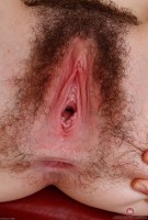 ATK hairy  in young and hairy