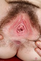 ATK hairy  in young and hairy