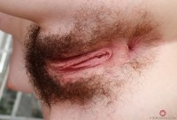 ATK hairy  in young and hairy