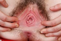 ATK hairy  in young and hairy