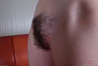 ATK hairy  in young and hairy