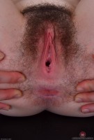 ATK hairy  in young and hairy