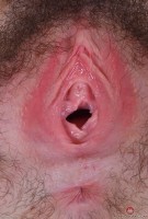ATK hairy  in hairy fun