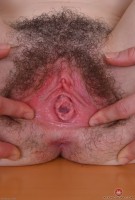 ATK hairy  in young and hairy