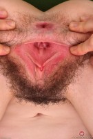 ATK hairy  in young and hairy