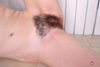 ATK hairy  in young and hairy