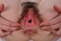 ATK hairy  in young and hairy