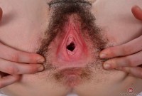 ATK hairy  in young and hairy