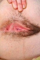 ATK hairy  in young and hairy