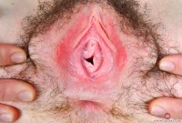 ATK hairy  in hairy fun