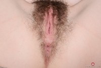ATK hairy  in young and hairy