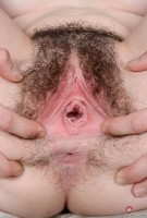 ATK hairy  in young and hairy