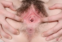ATK hairy  in young and hairy