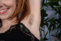 ATK hairy  in young and hairy