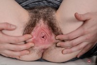 ATK hairy  in young and hairy