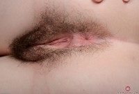 ATK hairy  in young and hairy