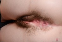 ATK hairy  in young and hairy