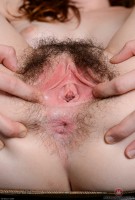 ATK hairy  in young and hairy