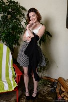 ATK hairy  in young and hairy