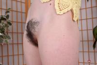 ATK hairy  in young and hairy