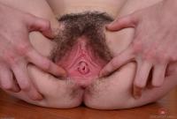 ATK hairy  in young and hairy