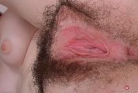 ATK hairy  in young and hairy