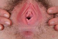 ATK hairy  in young and hairy