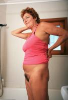 ATK hairy  in mature and hairy